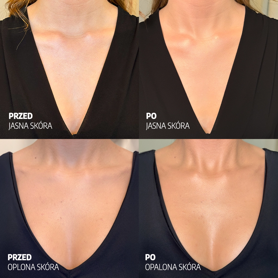 Efekt przed i po – rozświetlacz